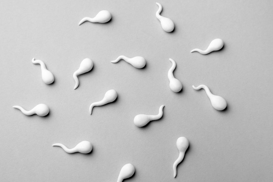 Male-Infertility-Sperm