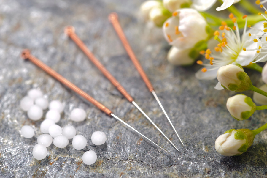 Fertility Acupuncture