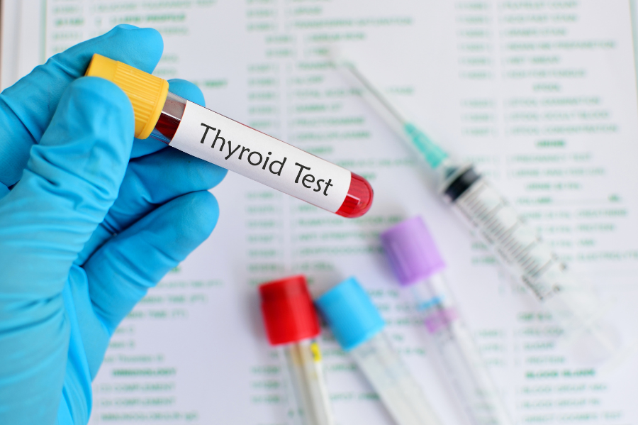 Thyroid Testing (1)